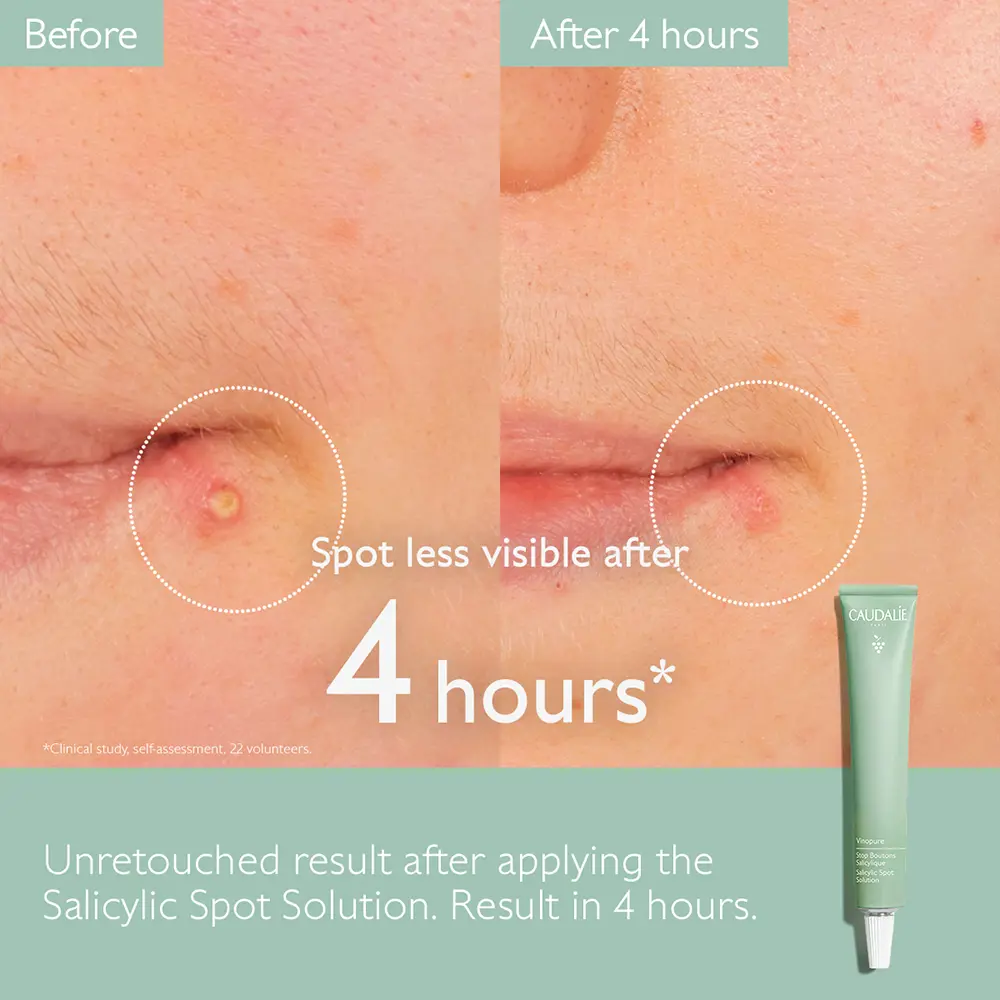 CAUDALIE VINOPURE Salicylsäure-Spotlösung 15 ml