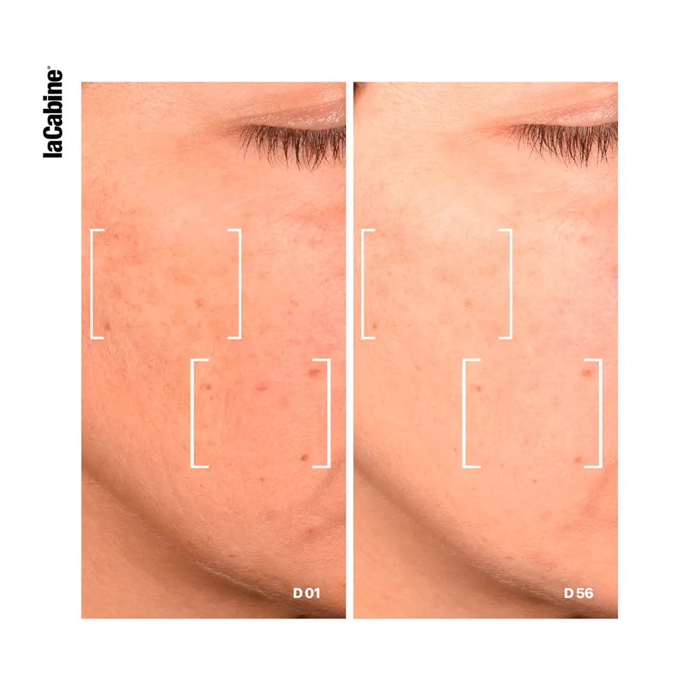 LA CABINE 25% NIACINAMIDE PRO COMPLEX advanced serum 30 ml LA CABINE 25% NIACINAMIDE PRO COMPLEX advanced serum 30 ml - Image 3