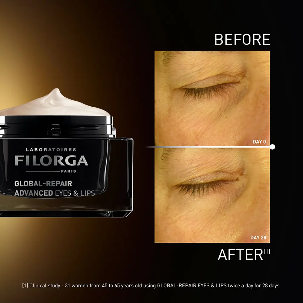 <span class="notranslate">LABORATOIRES FILORGA GLOBAL-REPAIR</span> Eyes & Lips Revitalizing Cream 15 ml <span class="notranslate">LABORATOIRES FILORGA GLOBAL-REPAIR</span> Eyes & Lips Revitalizing Cream 15 ml - Image 4